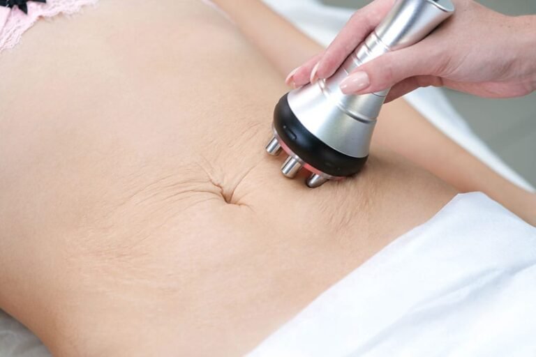 radio_frequency_skin_tightening